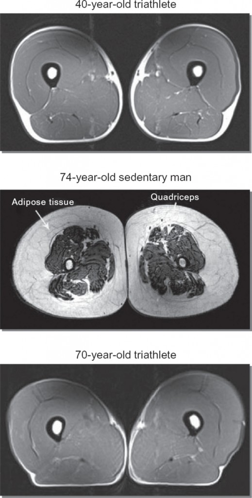 from Wroblewski et al., Phys Sportsmed. 2011 Sep;39(3):172-8. doi: 10.3810/psm.2011.09.1933.